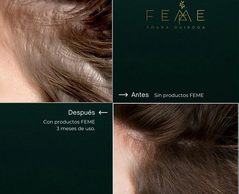 FEME